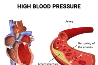 Understanding High Blood Pressure: A Global Crisis
